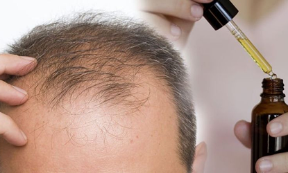 Medical Hair Treatment