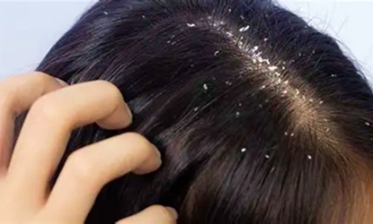Scalp Treatment