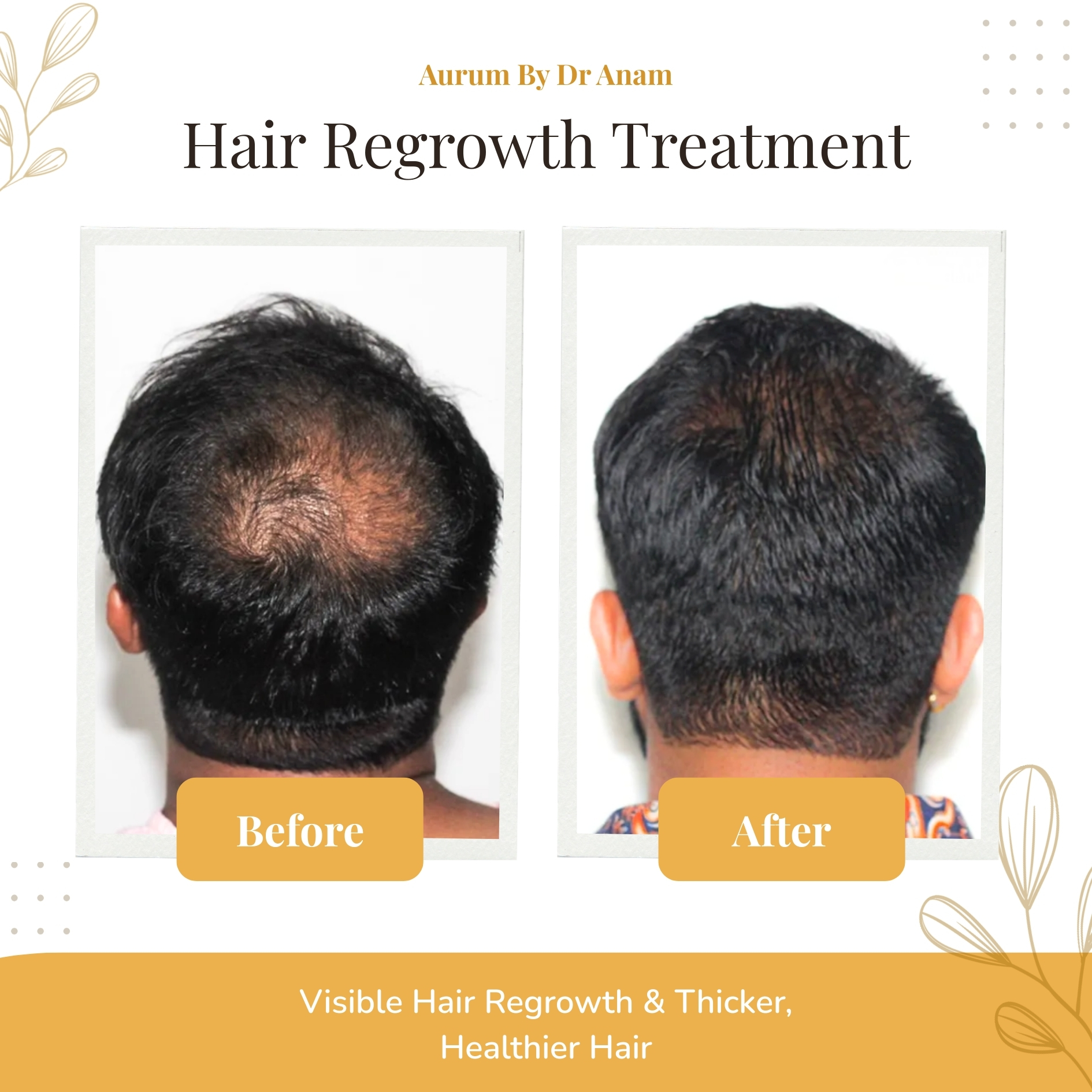 After Treatment Result 1