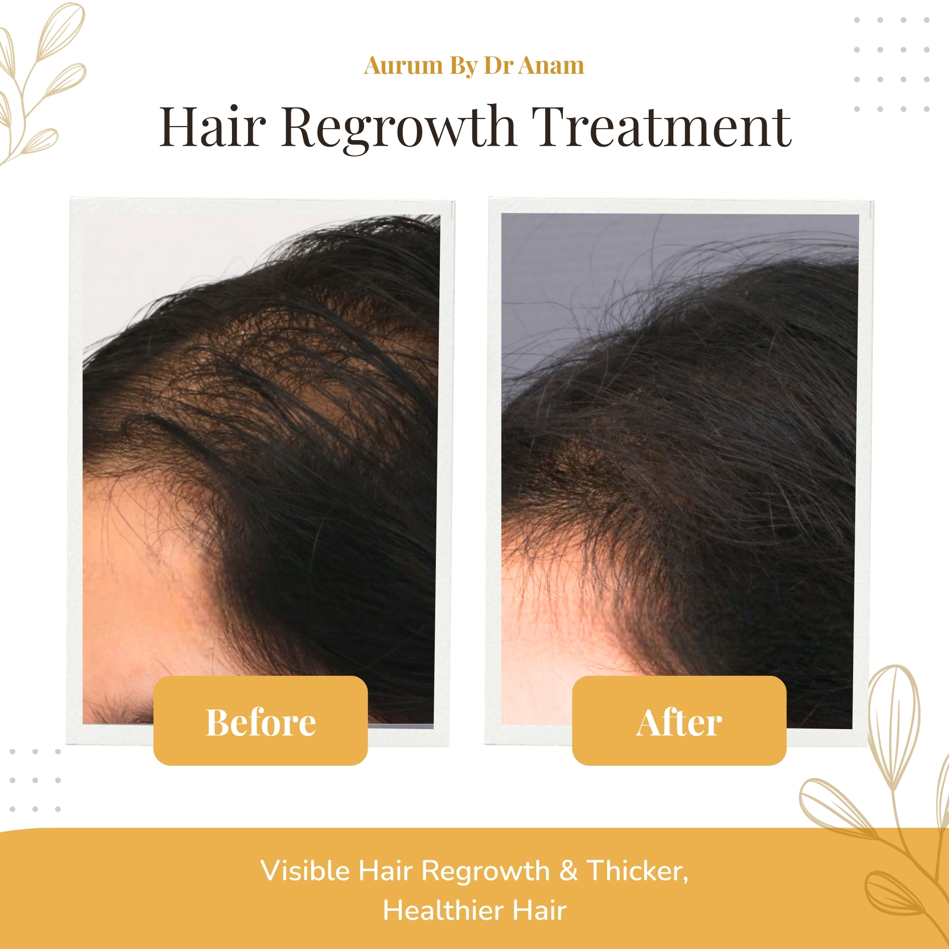 After Treatment Result 2