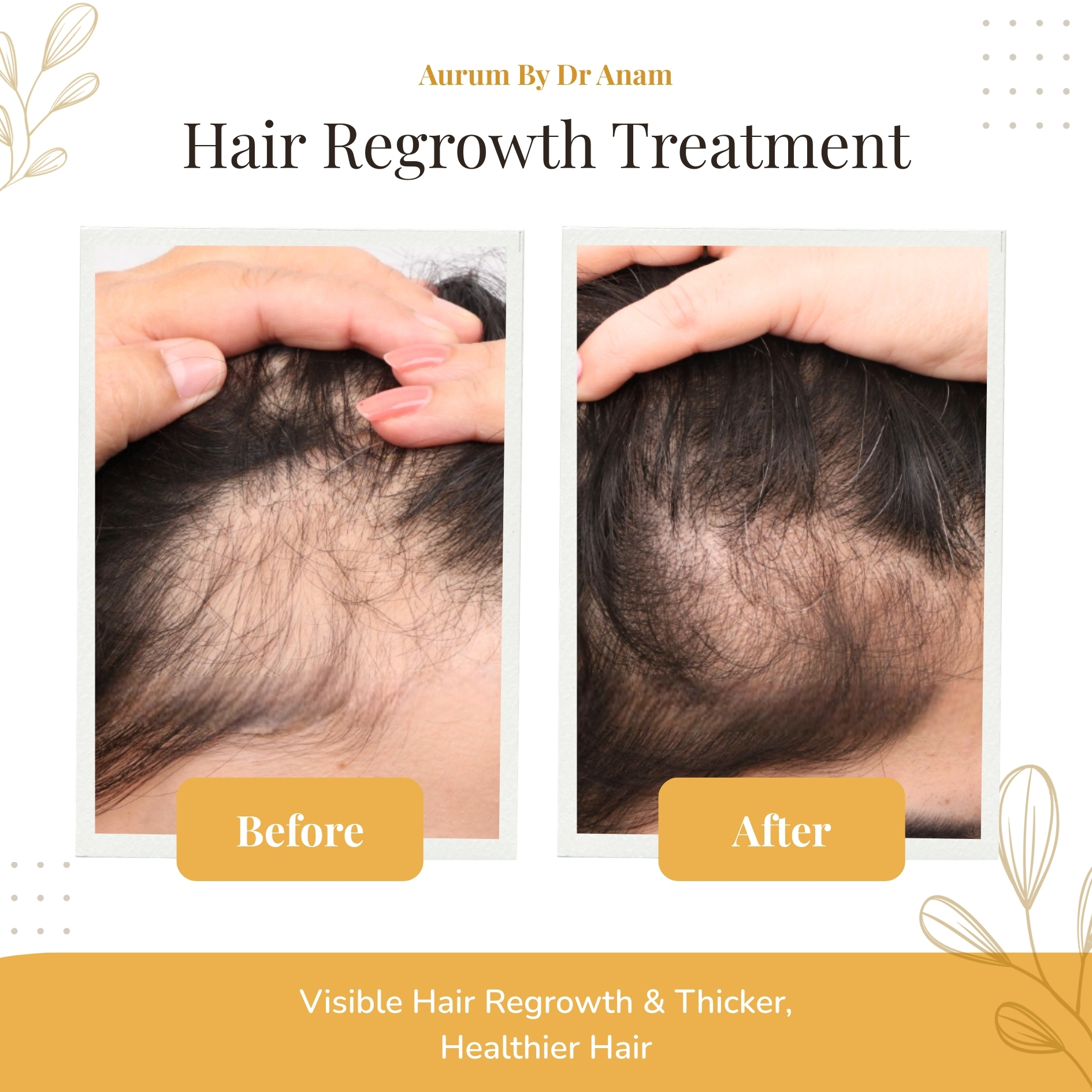 After Treatment Result 3