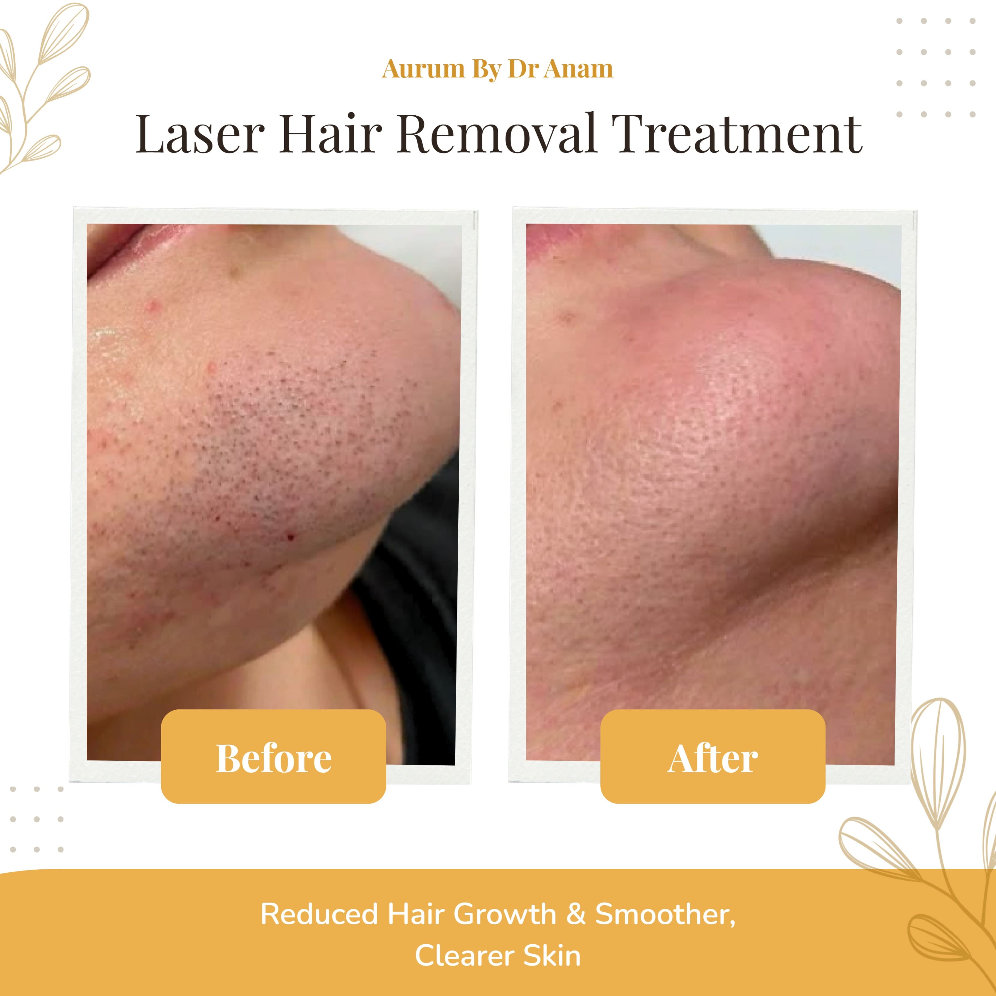 After Treatment Result 1