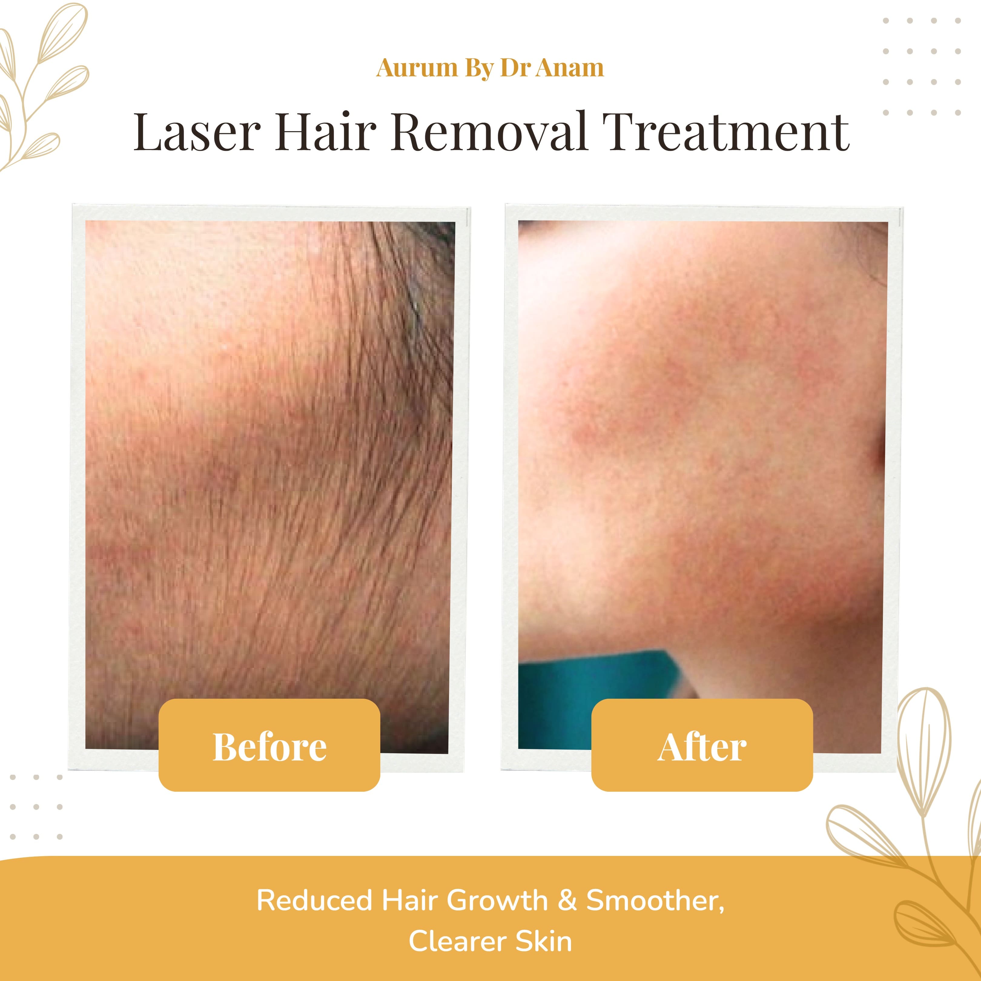 After Treatment Result 2