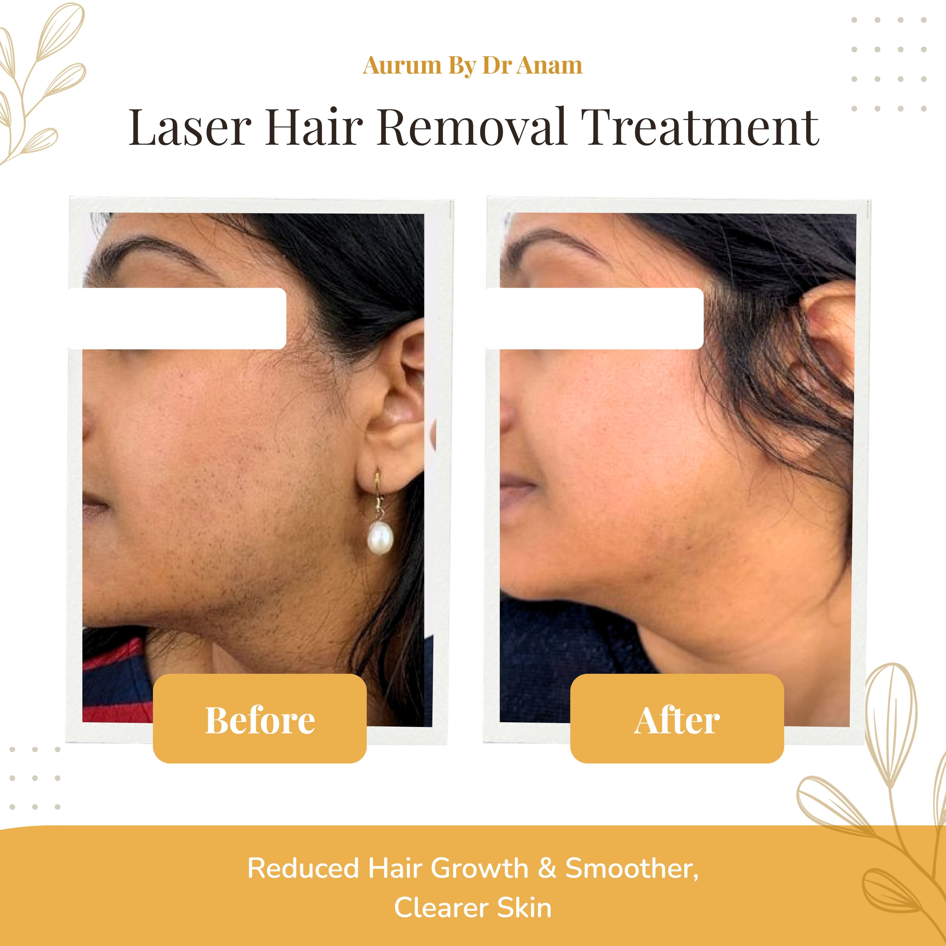 After Treatment Result 3