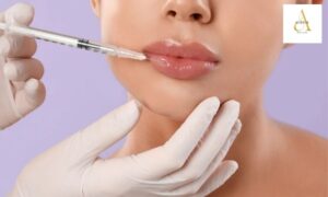 Do Lip Fillers in Punjabi Bagh Actually Look Natural or Is That Just Marketing?