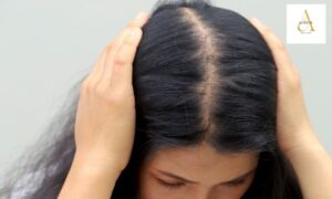 Hair Fall Treatment in Punjabi Bagh: Causes, Solutions & Results