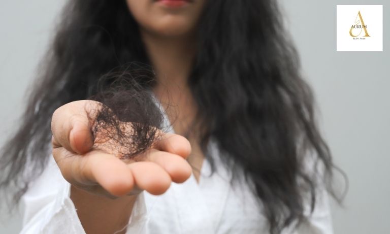 Hair Fall Treatment in Punjabi Bagh: Causes, Solutions & Results