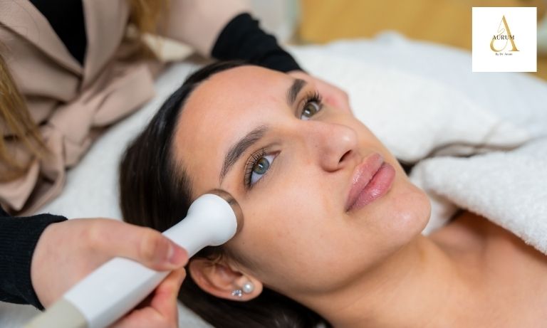 Non-surgical thread lift procedure for facial skin tightening in Delhi