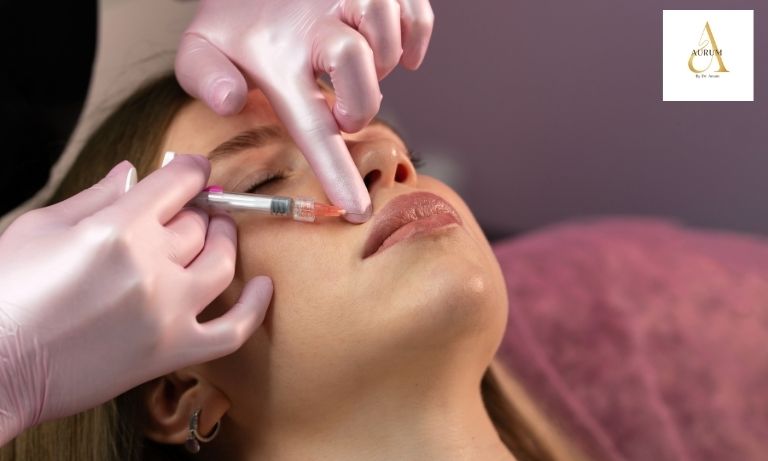 Lip filler consultation at Aurum by Dr Anam in Punjabi Bagh