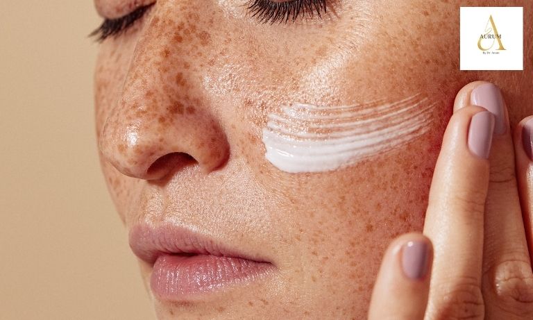 Pigmentation treatment consultation at Aurum by Dr Anam in Punjabi Bagh