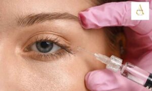 Are Under-Eye Fillers in Punjabi Bagh the Right Fix, or Is Something Else Causing Your Dark Circles?