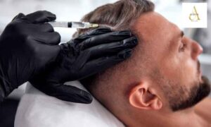 Best Hair Fall Treatment in Punjabi Bagh