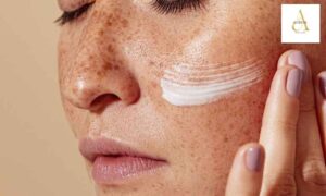 Pigmentation Treatment in Punjabi Bagh