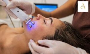 Bio Repeel in Punjabi Bagh: Benefits, Procedure, Results & Skin Rejuvenation