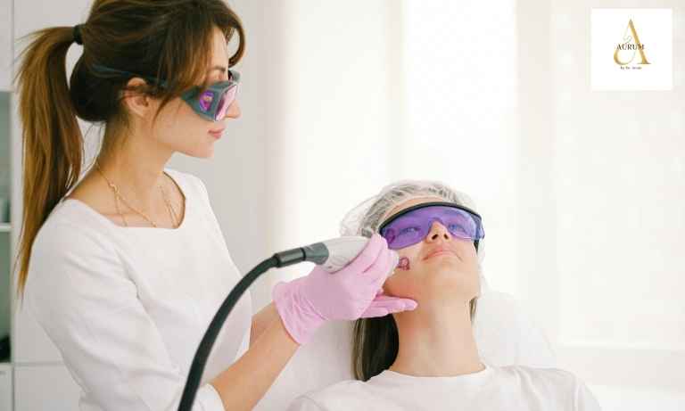 Laser Toning in Punjabi Bagh | Skin Brightening Treatment – Aurum